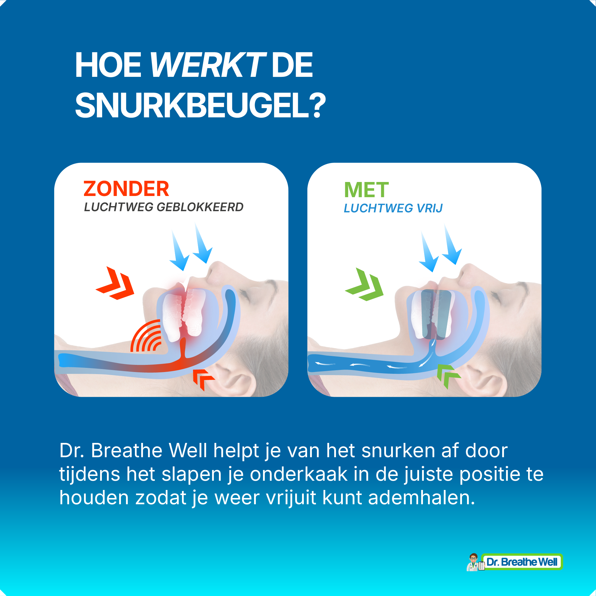 Dr. Breathe Well - Snurkbeugel zonder met