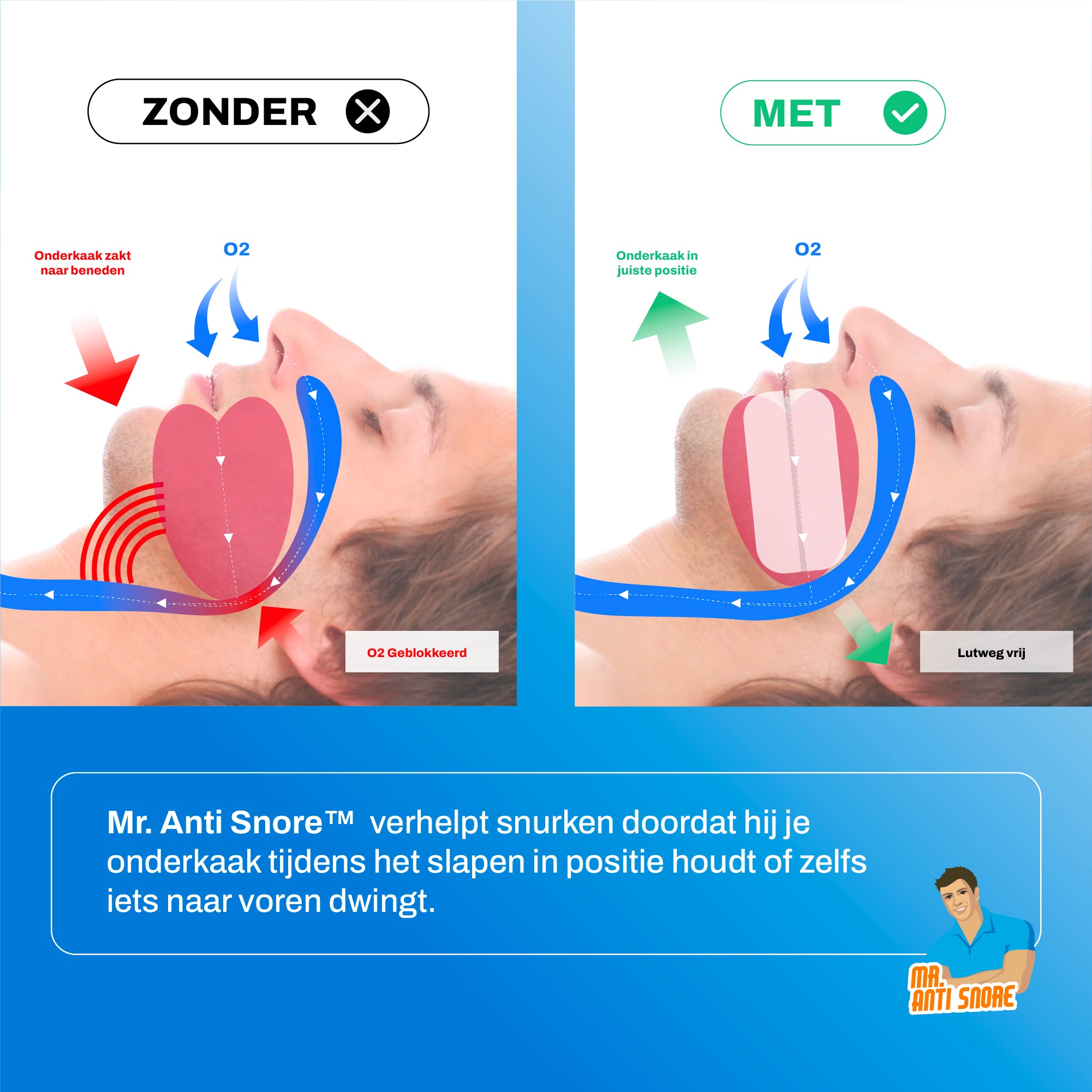 MRA-MMr. Anti Snurk - zonder met